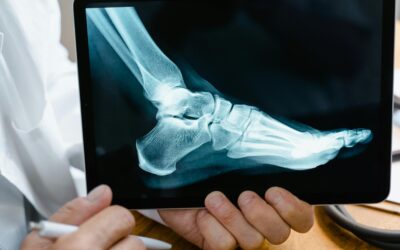 Medical Malpractice: When Care Fails